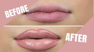 How to Get Beautiful Lips Naturally at Home 4 Before and after results showing how to get beautiful lips naturally at home