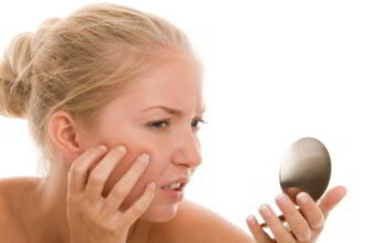 Natural remedies to get rid of acne scars, including aloe vera, honey, and turmeric for clear skin.