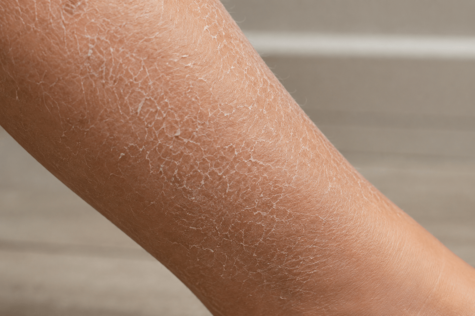 Close-up of dry, flaky skin on a person's lower leg