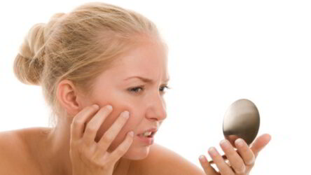 How Can You Get Rid of Acne Scars Naturally: Proven Home Remedies